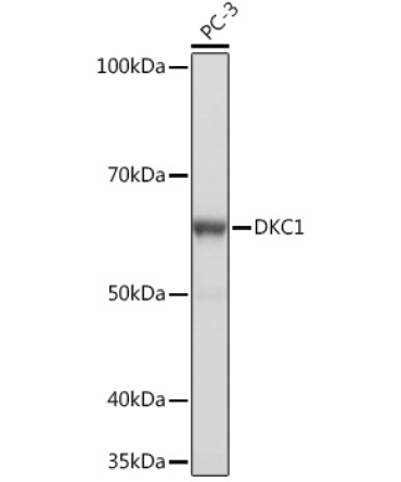DKC1 Rabbit Monoclonal Antibody