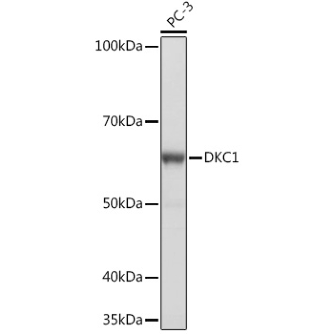 DKC1 Rabbit Monoclonal Antibody