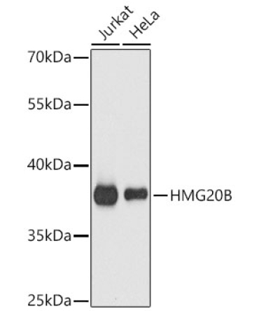 HMG20B Rabbit Polyclonal Antibody