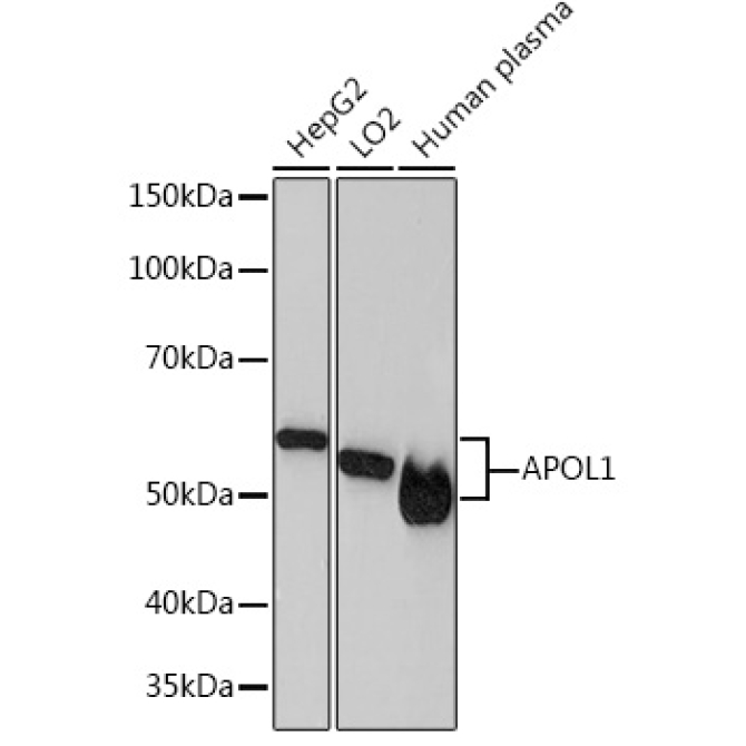 APOL1 Rabbit Monoclonal Antibody