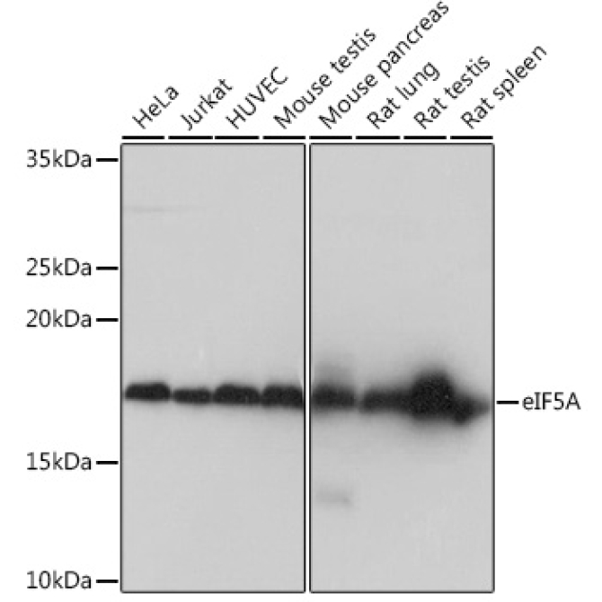 eIF5A Rabbit Monoclonal Antibody