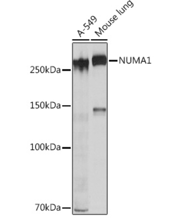 NUMA1 Rabbit Monoclonal Antibody