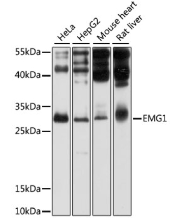 EMG1 Rabbit Polyclonal Antibody