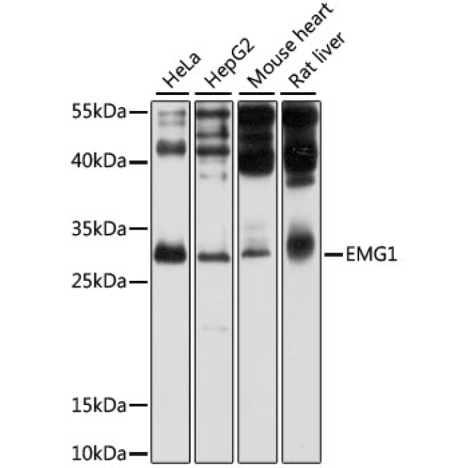 EMG1 Rabbit Polyclonal Antibody
