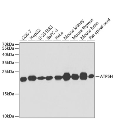 ATP5H Rabbit Polyclonal Antibody