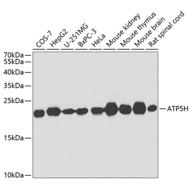 ATP5H Rabbit Polyclonal Antibody