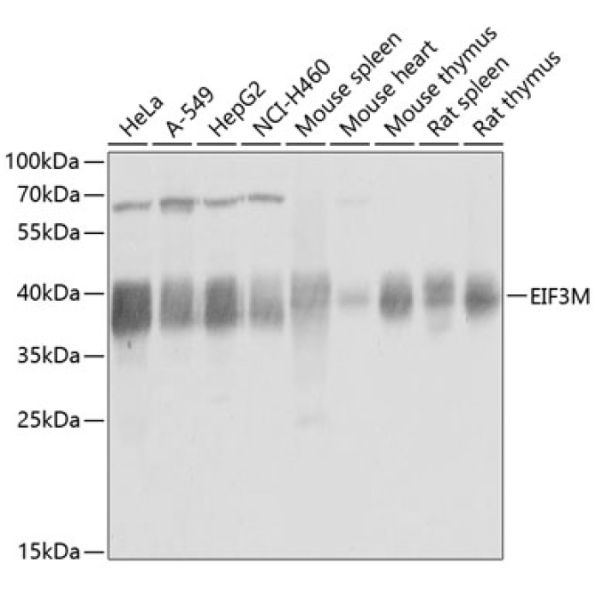 EIF3M Rabbit Polyclonal Antibody