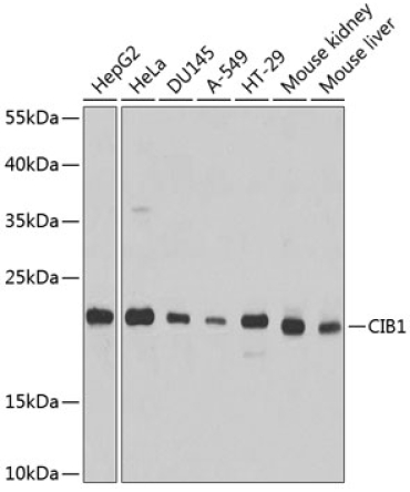 CIB1 Rabbit Polyclonal Antibody