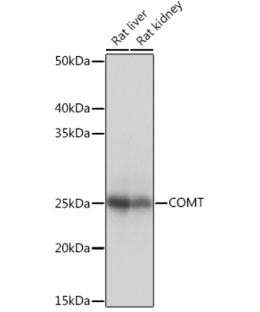 COMT Rabbit Monoclonal Antibody