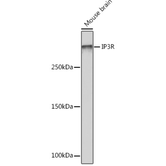 IP3R Rabbit Monoclonal Antibody