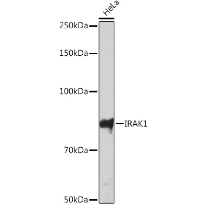 IRAK1 Rabbit Monoclonal Antibody