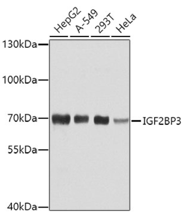 IGF2BP3 Rabbit Polyclonal Antibody