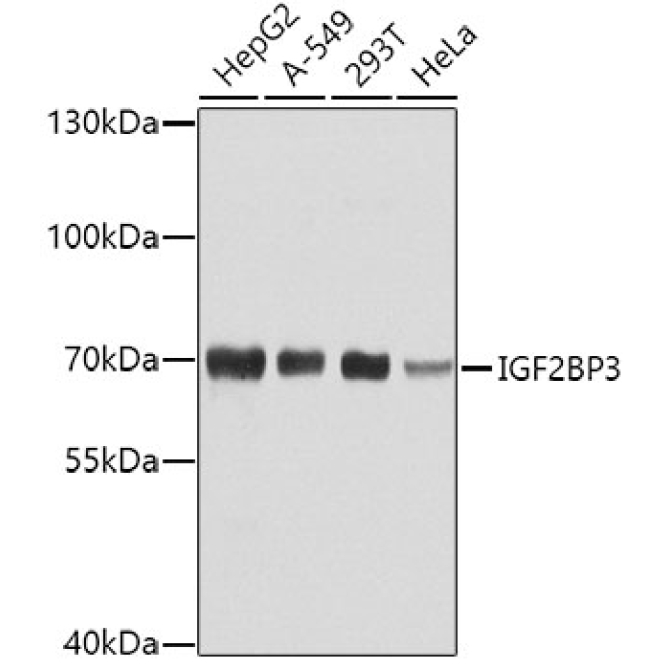 IGF2BP3 Rabbit Polyclonal Antibody