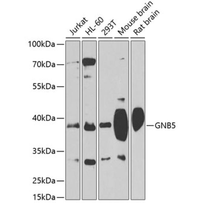 GNB5 Rabbit Polyclonal Antibody