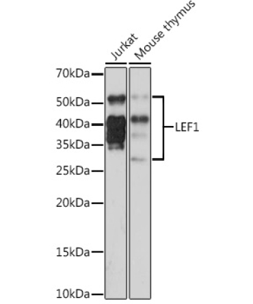 LEF1 Rabbit Monoclonal Antibody