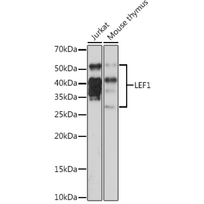 LEF1 Rabbit Monoclonal Antibody