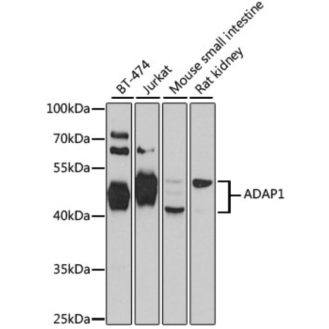 ADAP1 Rabbit Polyclonal Antibody
