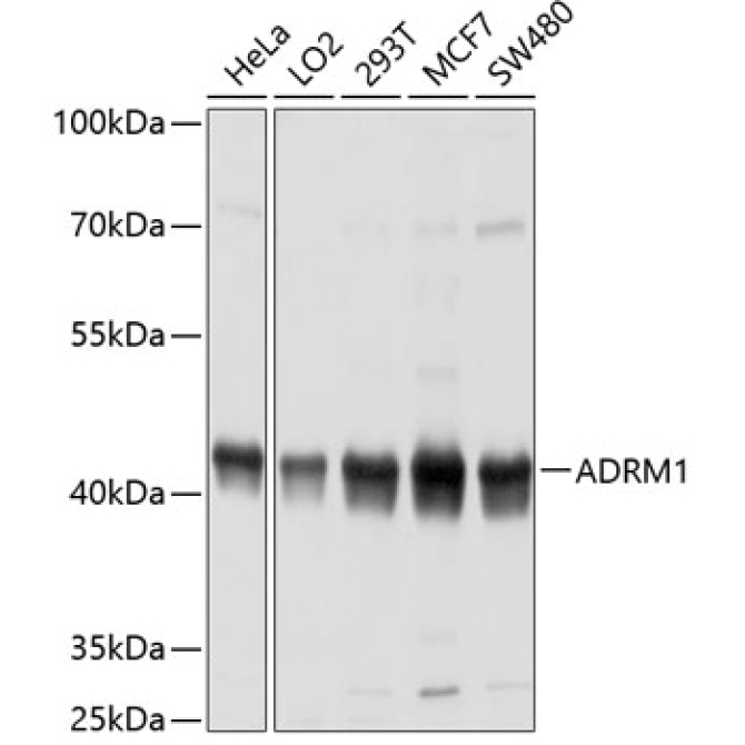 ADRM1 Rabbit Polyclonal Antibody