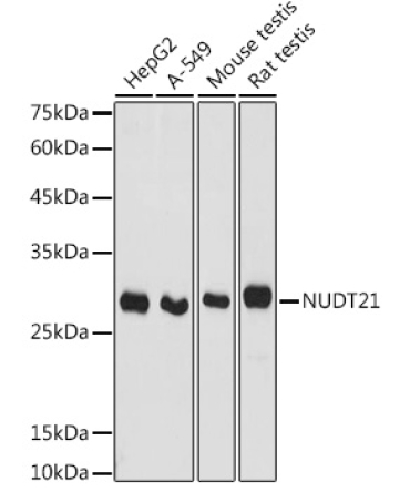 NUDT21 Rabbit Polyclonal Antibody