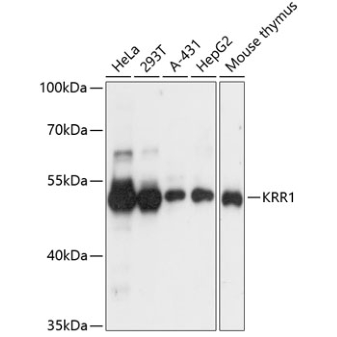 KRR1 Rabbit Polyclonal Antibody