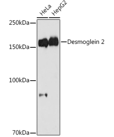 Desmoglein 2 Rabbit Monoclonal Antibody