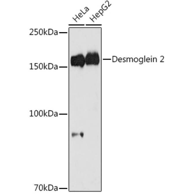 Desmoglein 2 Rabbit Monoclonal Antibody