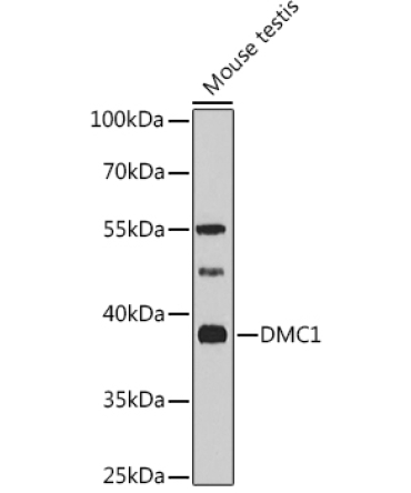 DMC1 Rabbit Polyclonal Antibody