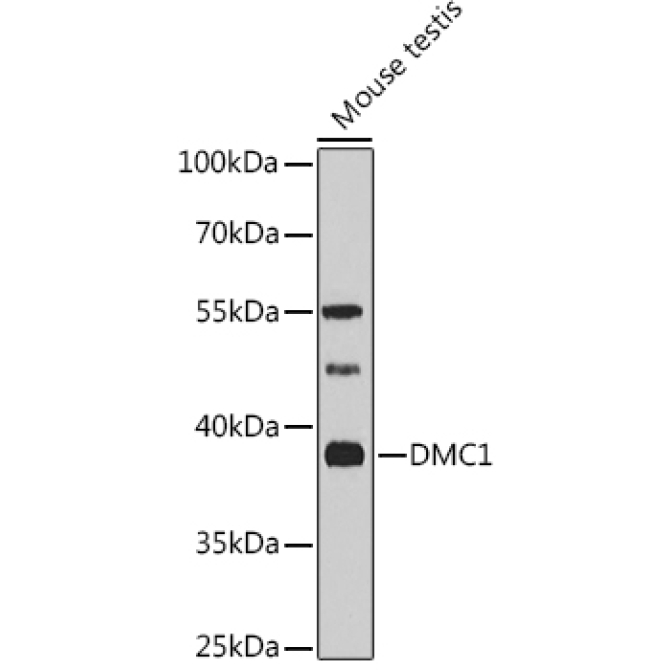DMC1 Rabbit Polyclonal Antibody