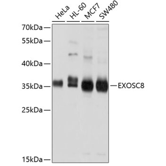 EXOSC8 Rabbit Polyclonal Antibody
