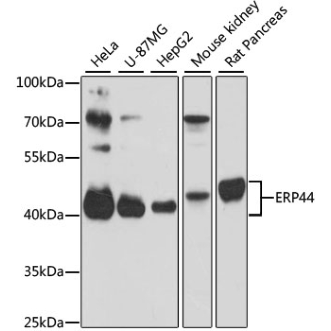 ERP44 Rabbit Polyclonal Antibody