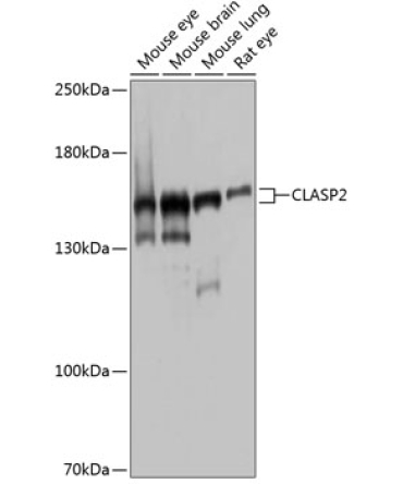 CLASP2 Rabbit Polyclonal Antibody