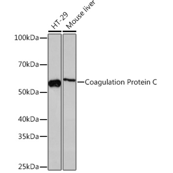 Coagulation Protein C Rabbit Monoclonal Antibody
