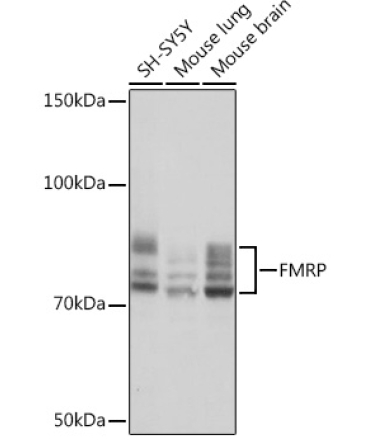 FMRP Rabbit Monoclonal Antibody