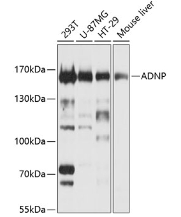 ADNP Rabbit Polyclonal Antibody