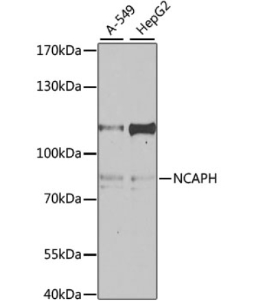 NCAPH Rabbit Polyclonal Antibody