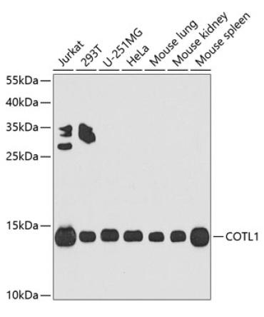 COTL1 Rabbit Polyclonal Antibody