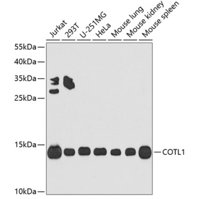 COTL1 Rabbit Polyclonal Antibody