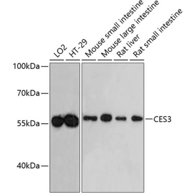 CES3 Rabbit Polyclonal Antibody