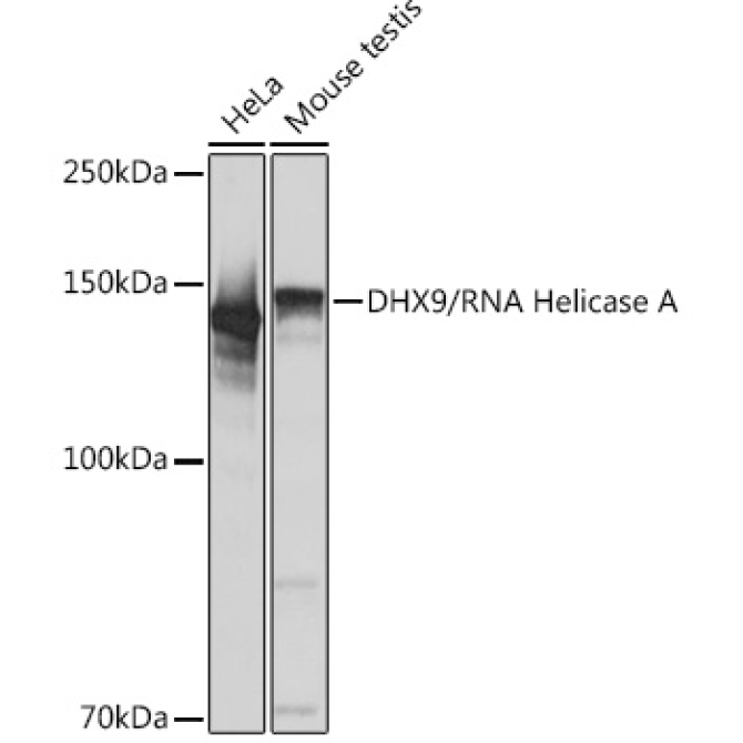 DHX9/RNA Helicase A Rabbit Monoclonal Antibody