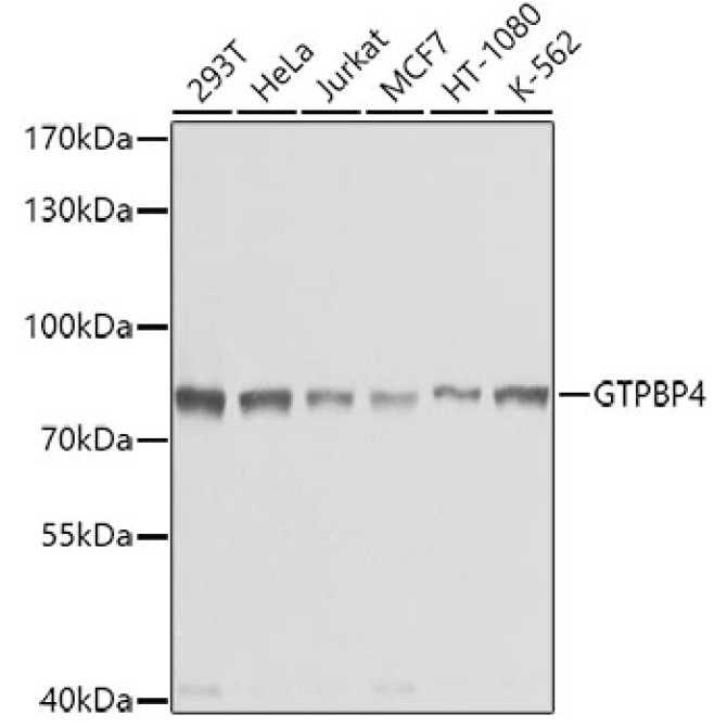 GTPBP4 Rabbit Polyclonal Antibody