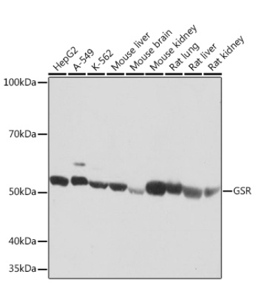 GSR Rabbit Monoclonal Antibody