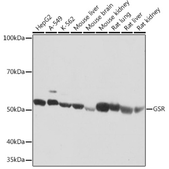GSR Rabbit Monoclonal Antibody