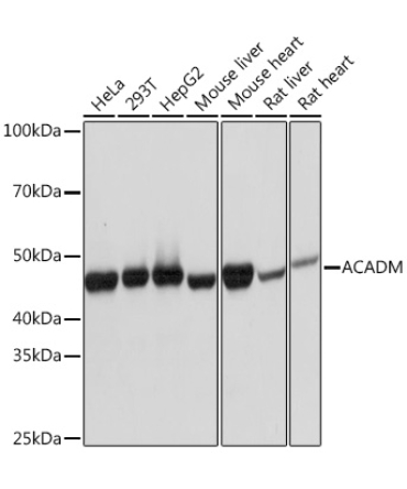 ACADM Rabbit Monoclonal Antibody
