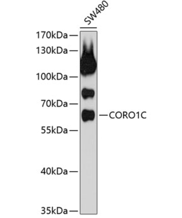 CORO1C Rabbit Polyclonal Antibody