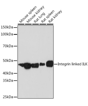 Integrin linked ILK Rabbit Monoclonal Antibody