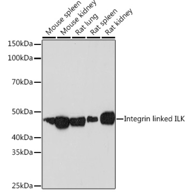 Integrin linked ILK Rabbit Monoclonal Antibody