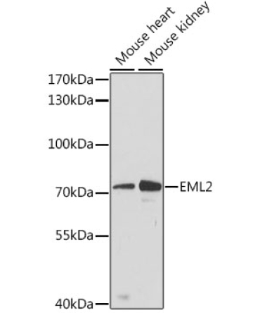 EML2 Rabbit Polyclonal Antibody