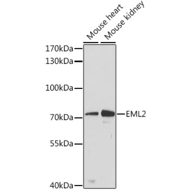 EML2 Rabbit Polyclonal Antibody