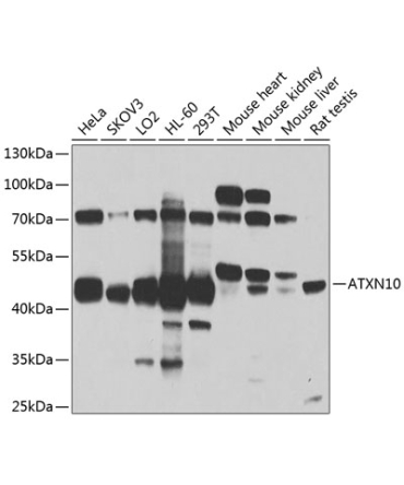 ATXN10 Rabbit Polyclonal Antibody