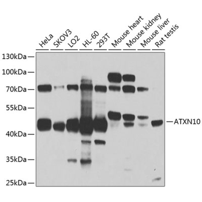 ATXN10 Rabbit Polyclonal Antibody